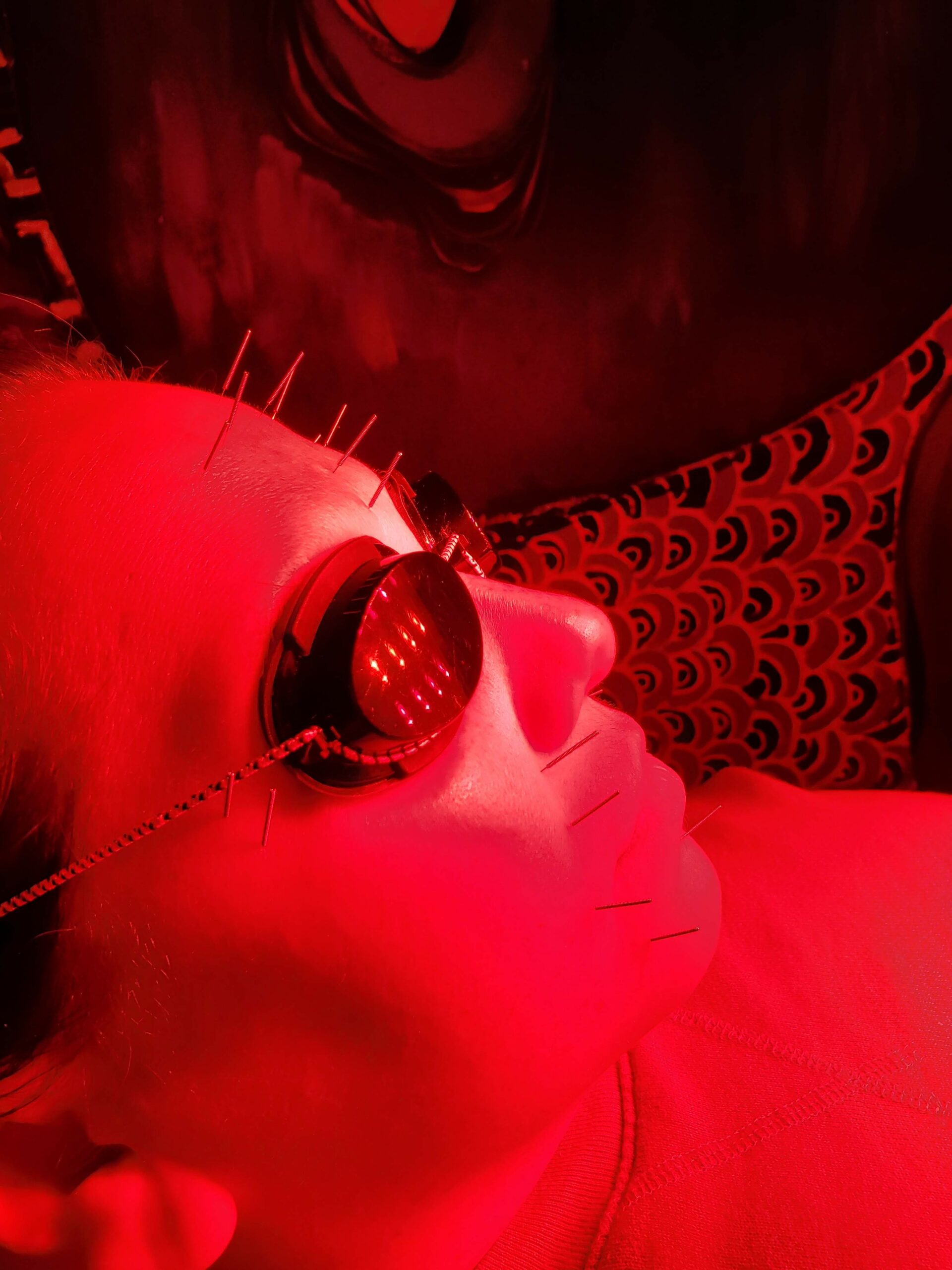 Southtown Chiropractic’s LED Acupuncture Facial Treatment Southtown Chiropractic’s LED Acupuncture Facial Treatment